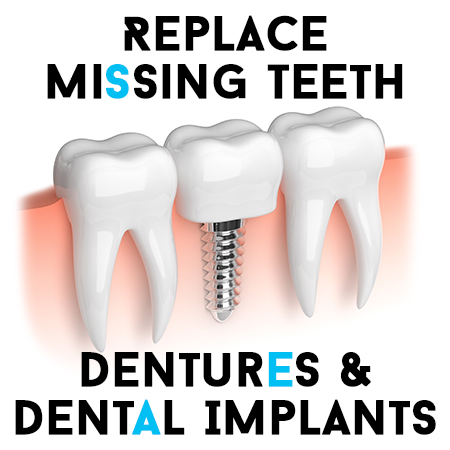 Dentures Implants
